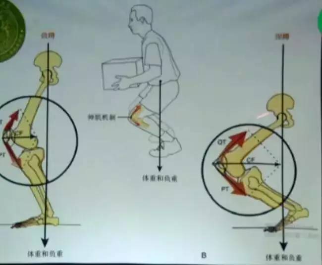 在搞清楚病因病理之前我们要先明白膝关节周围的相关肌肉，因为膝关节其实也和一般的机械原理是相通的，是滑轮及杠杆的组合。